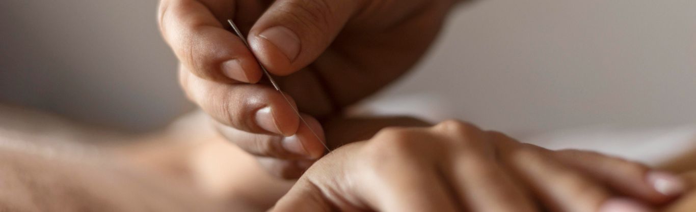Qual è l'efficacia dell’agopuntura?