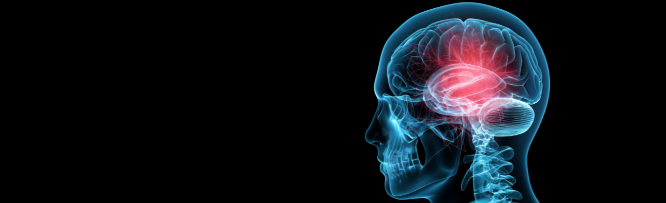 Giornata Mondiale dell'Ictus