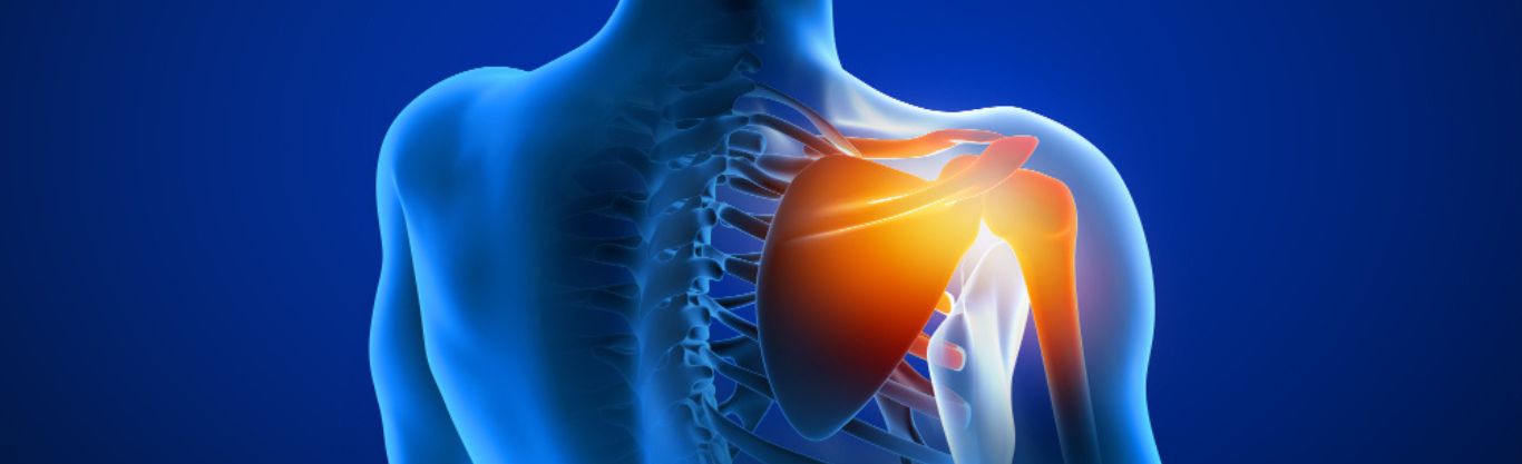 Le onde d’urto in campo muscolo-scheletrico