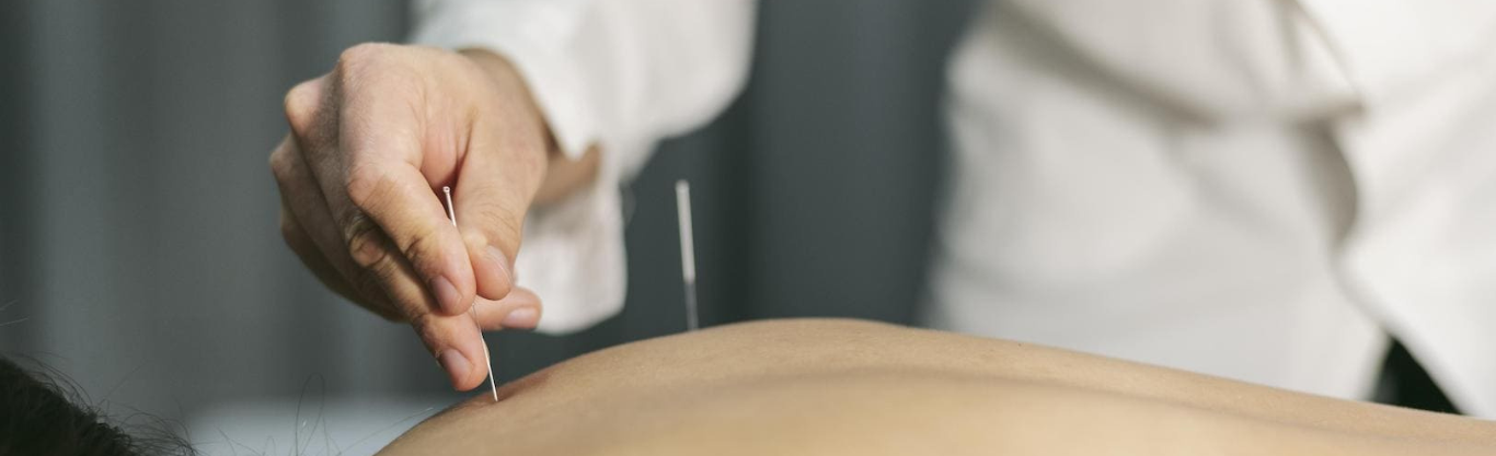 Che cos'è l'agopuntura? come funziona?