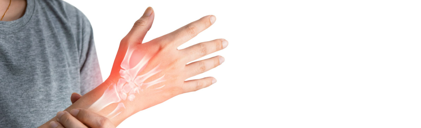 Quali sono i sintomi dell'osteoporosi?