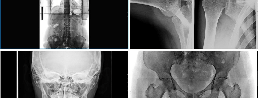 Radiologia convenzionale