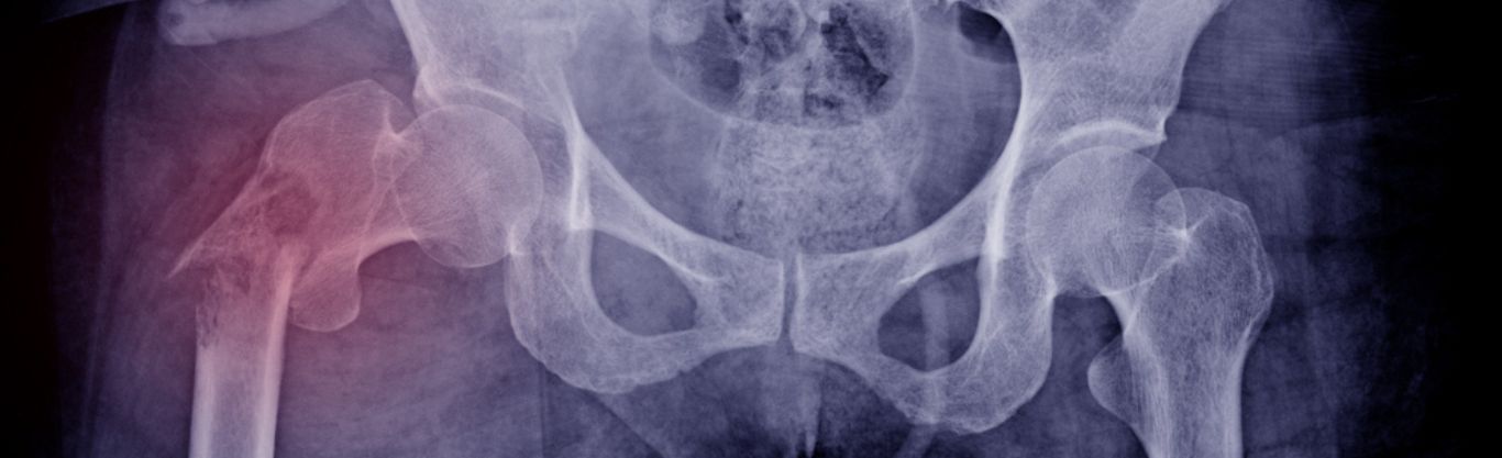 Osteodensitometria all’avanguardia